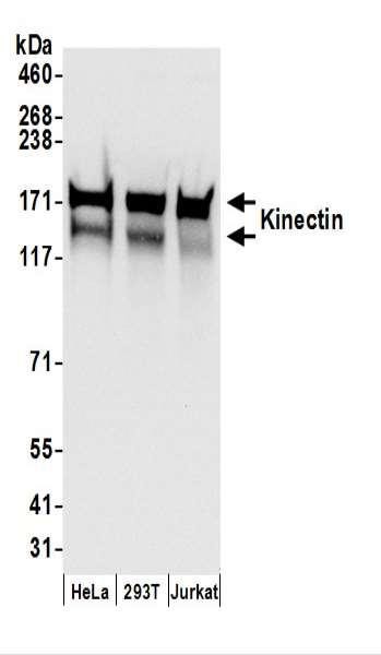 Anti-Kinectin