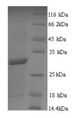 Diacylglycerol acyltransferase/mycolyltransferase Ag85B (fbpB), Mycobacterium tuberculosis, recombin