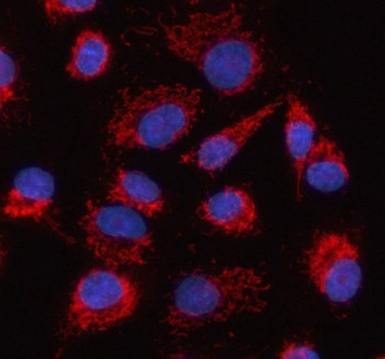 Anti-HDGFL2 / Hepatoma-derived growth factor-related protein 2