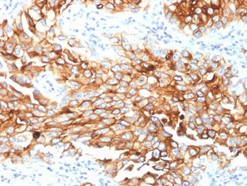 Anti-Mesothelin / MSLN, clone MSLN/2131