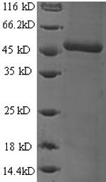 DCN1-like protein 1 (DCUN1D1), human, recombinant