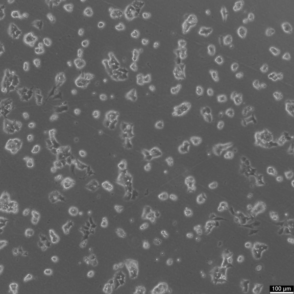 SK-N-MC Cells