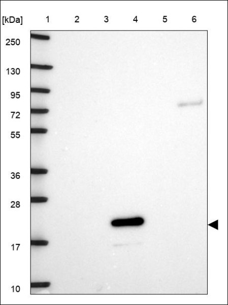 Anti-RBM38