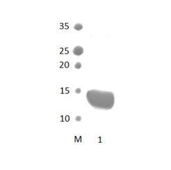 SCRIB_4 PDZ Domain