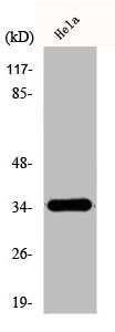 Anti-OR51E1