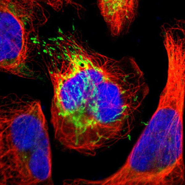Anti-ATP5B
