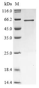 Protein GOLM2 (GOLM2), partial, human, recombinant