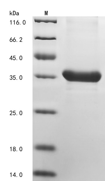 Serine/threonine-protein kinase 38-like (STK38L), partial, human, recombinant