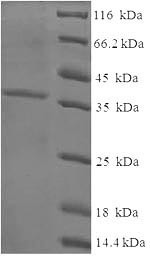 Cysteine and glycine-rich protein 3 (CSRP3), human, recombinant