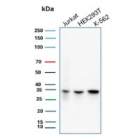 Anti-Cdk2 / p34cdc2 Serine-Threonine Kinase, clone AN21.2