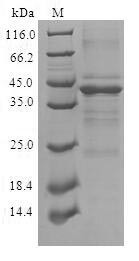 Complexin-2 (CPLX2), human, recombinant