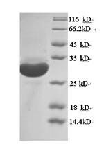 Macrosialin (Cd68), partial, mouse, recombinant