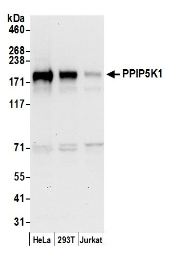 Anti-PPIP5K1/HISPPD2A