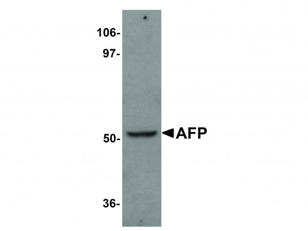 Anti-AFP