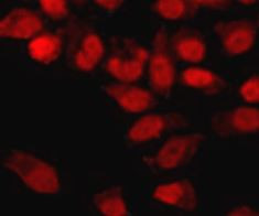 Anti-Ku70, clone 7B1-E12-G4