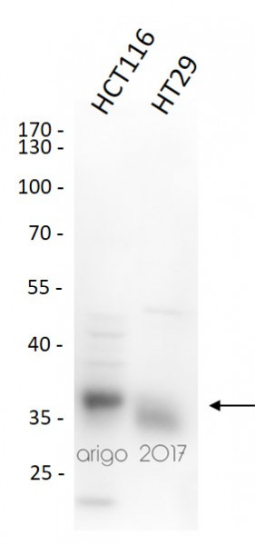 Anti-EpCAM