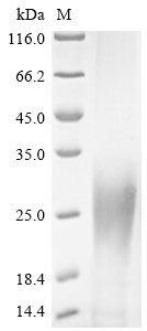 Super small secreted glycoprotein (GP), Zaire ebolavirus, recombinant