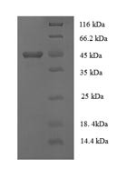 Collagen alpha-1 (XVIII) chain (COL18A1), partial, human, recombinant