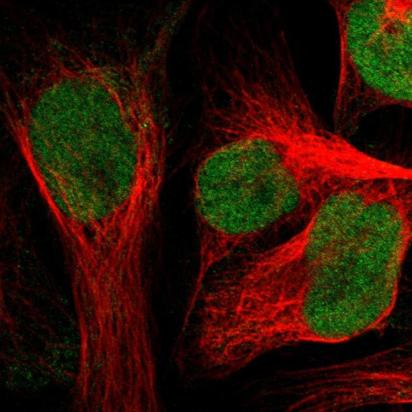 Anti-ZNF22