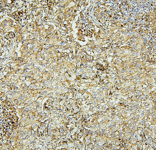 Anti-SDHB, clone 2I3