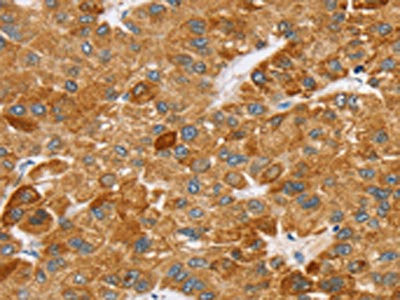 Anti-SPARCL1
