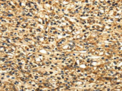 Anti-SLC6A19