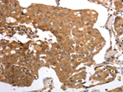 Anti-MMP27