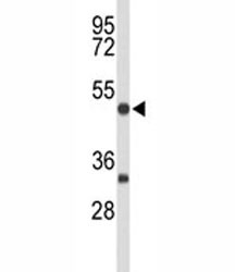 Anti-MEF2A