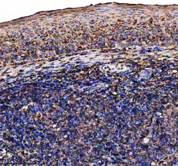 Anti-IL7RA / Interleukin-7 receptor alpha / CD127, clone 22I71