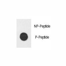 Anti-phospho-E2F1 (His357)
