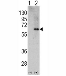 Anti-AMPK alpha 2 / PRKAA2