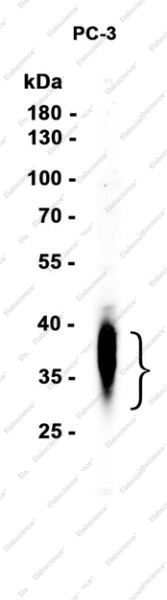 Anti-Recombinant DKK1, clone C322758