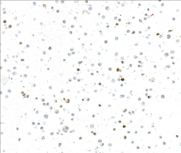 Anti-INSM1 Recombinant Monoclonal