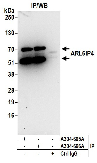 Anti-ARL6IP4