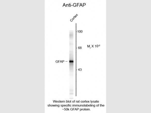 Anti-Glial Fibrillary Acidic Protein (GFAP)