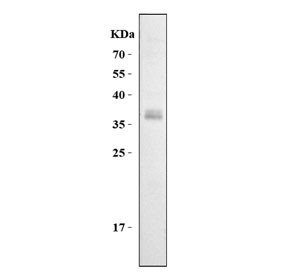Anti-Cd7