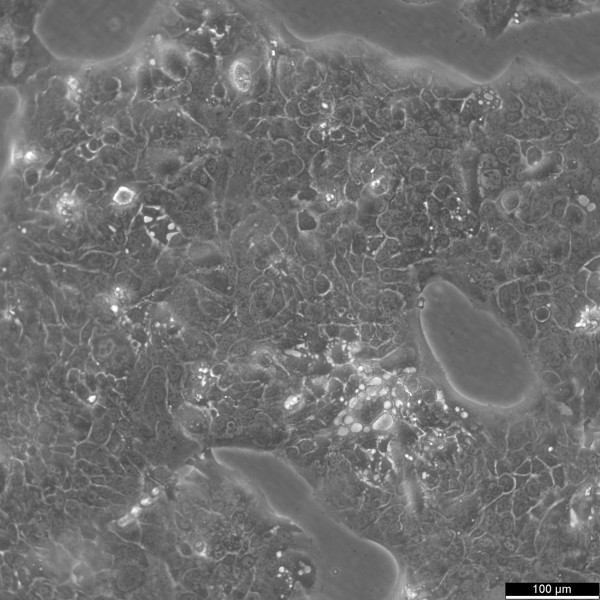 CERV-196 Cells