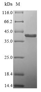 Platelet glycoprotein Ib beta chain (GP1BB), human, recombinant