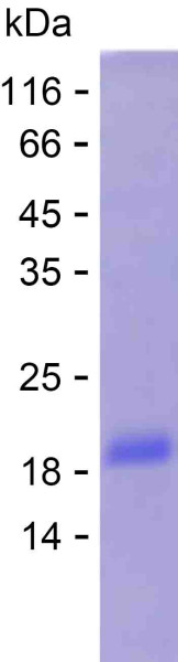 Recombinant Human ALDH3B2 Protein
