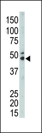 Anti-SPHK1