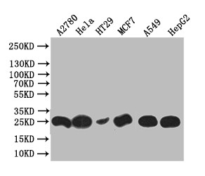Anti-WFDC2 Recombinant Monoclonal, clone 17D2