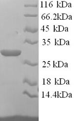 Asialoglycoprotein receptor 1 (Asgr1), partial, mouse, recombinant