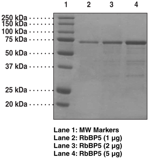 RbBP5 (human, recombinant)