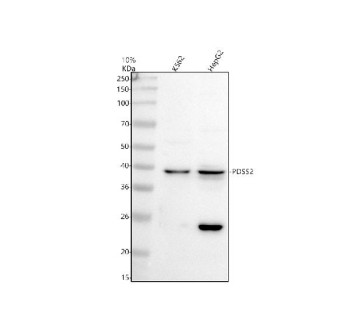 Anti-PDSS2 / Prenyl diphosphate synthase subunit 2