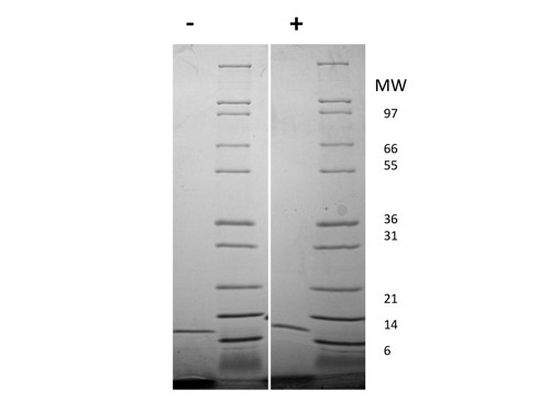 Interleukin-13