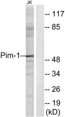 Anti-Pim-1