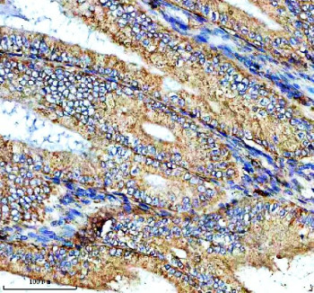 Anti-NTN4 / Netrin 4