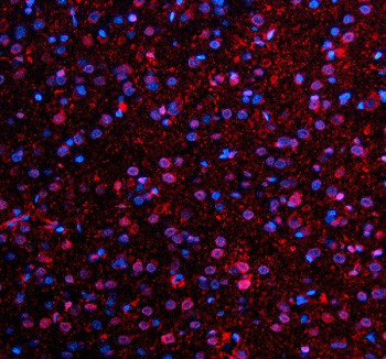 Anti-NMNAT1 / Nicotinamide mononucleotide adenylyltransferase 1