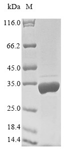 Filamin-A-interacting protein 1 (FILIP1), partial, human, recombinant
