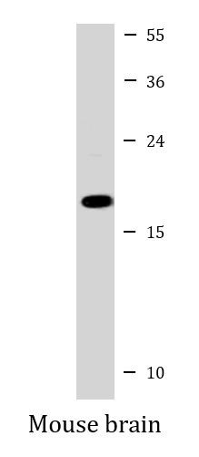 Anti-Complexin 1